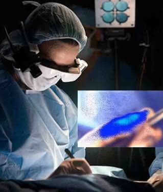 Chirurg z goglami AR i komórki rakowe
