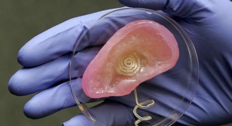  Bioniczne ucho wydrukowane w 3D