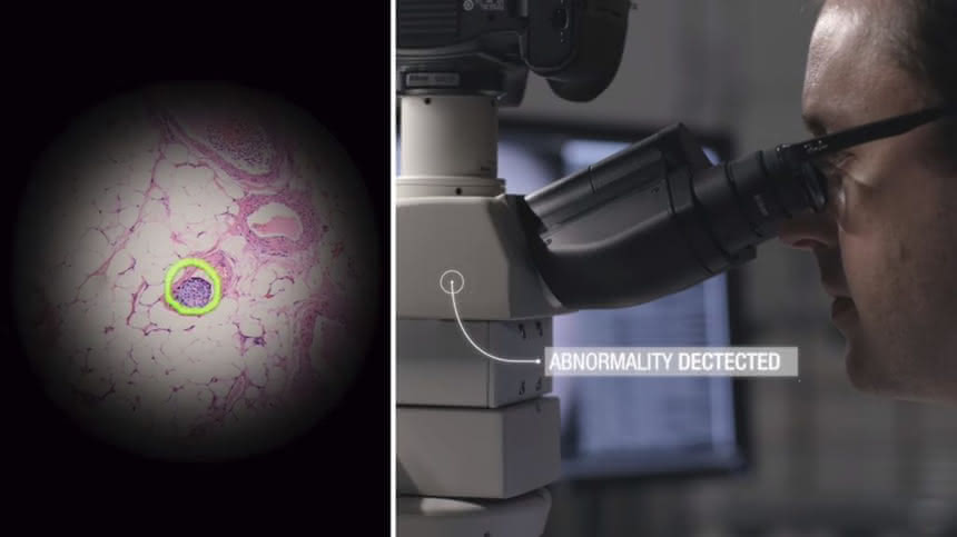 Mikroskop AR wykrywający patologiczne zmiany