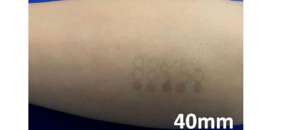 Grafenowy tatuaż do mierzenia ciśnienia