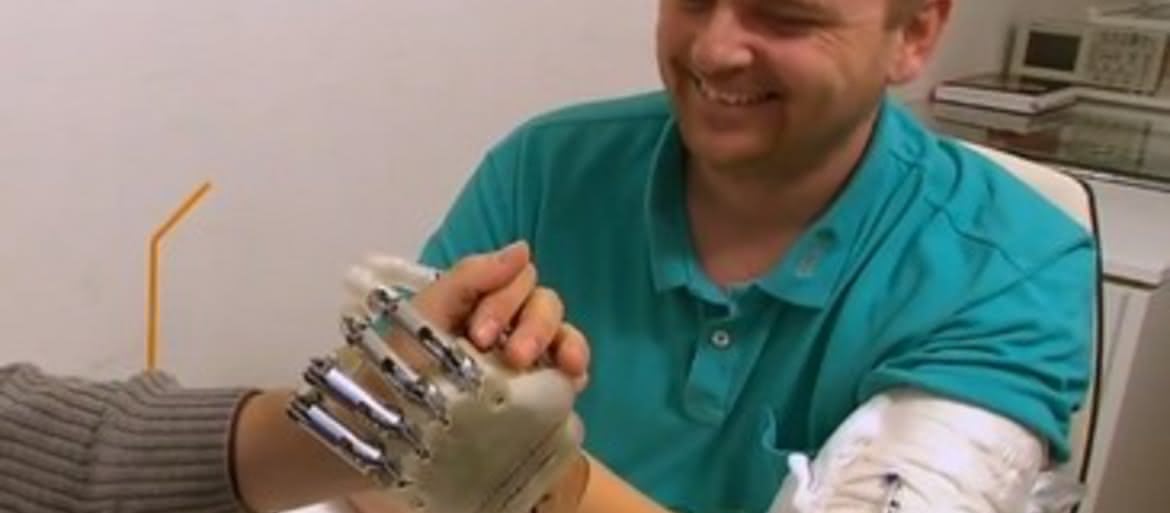 Bioniczna ręka sprawia się znów „czuje się” powierzchnie i kształty