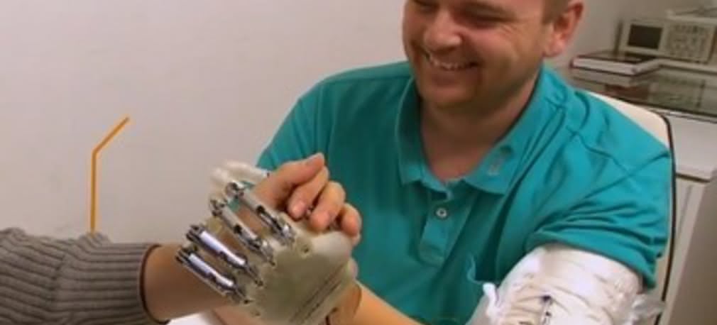 Bioniczna ręka sprawia się znów „czuje się” powierzchnie i kształty