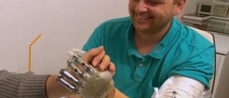 Bioniczna ręka sprawia się znów „czuje się” powierzchnie i kształty
