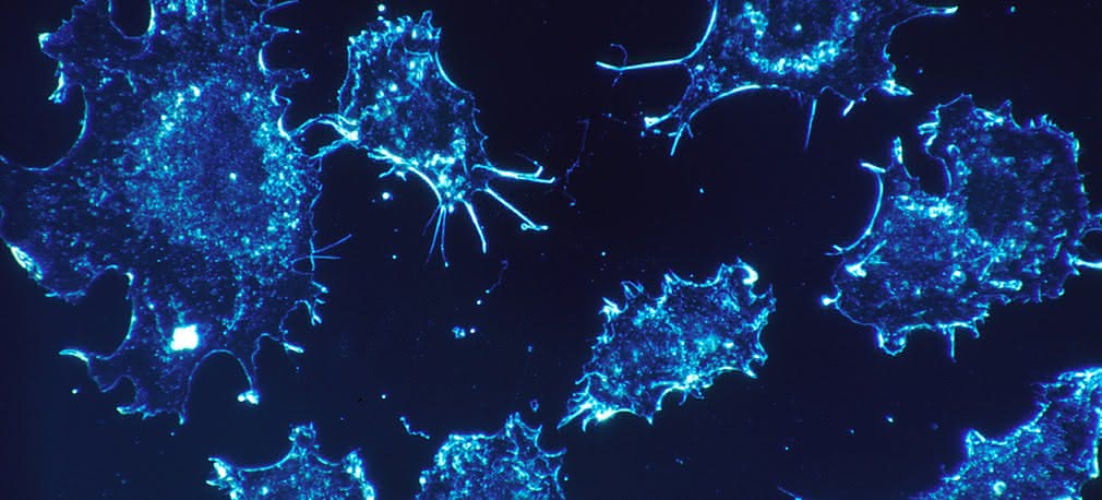 10-cio minutowy test na raka   