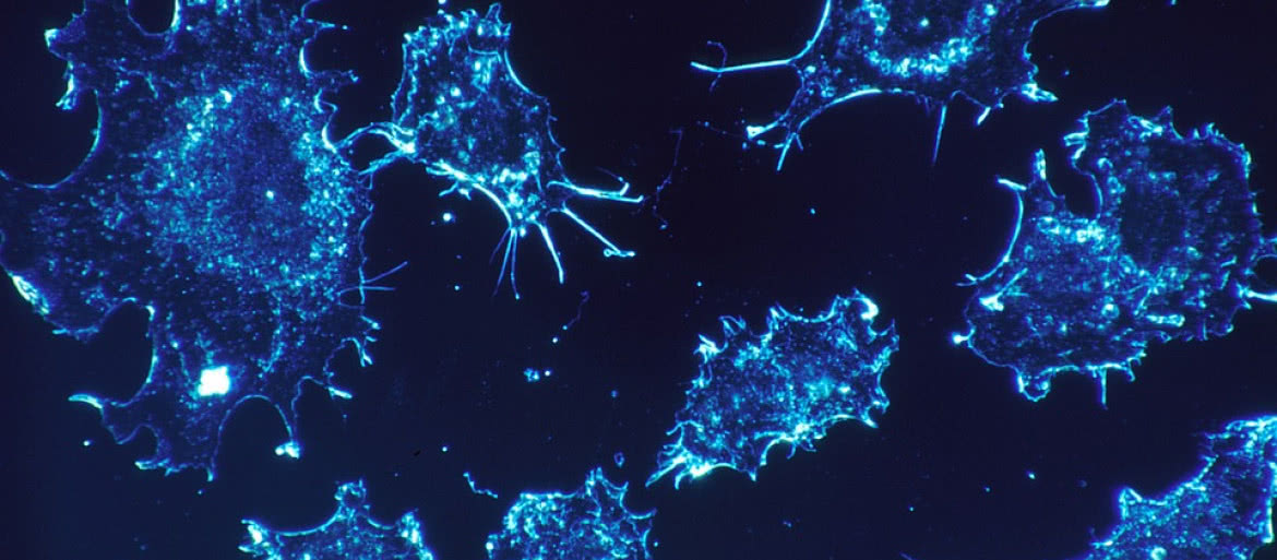 Mikrograwitacja zabija komórki nowotworowe