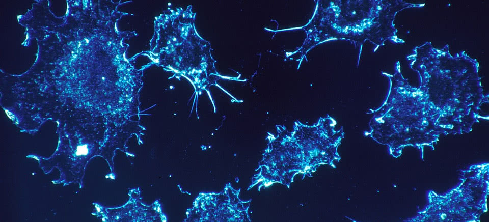 Mikrograwitacja zabija komórki nowotworowe