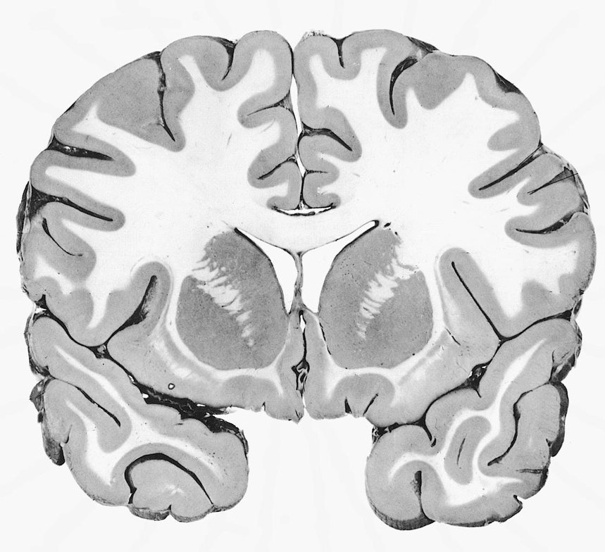 Substancje szara i biała w przekroju ludzkiego mózgu