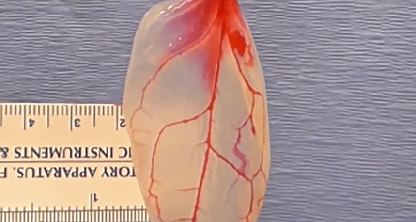 Liść szpinaku unaczyniony ludzką tkanką