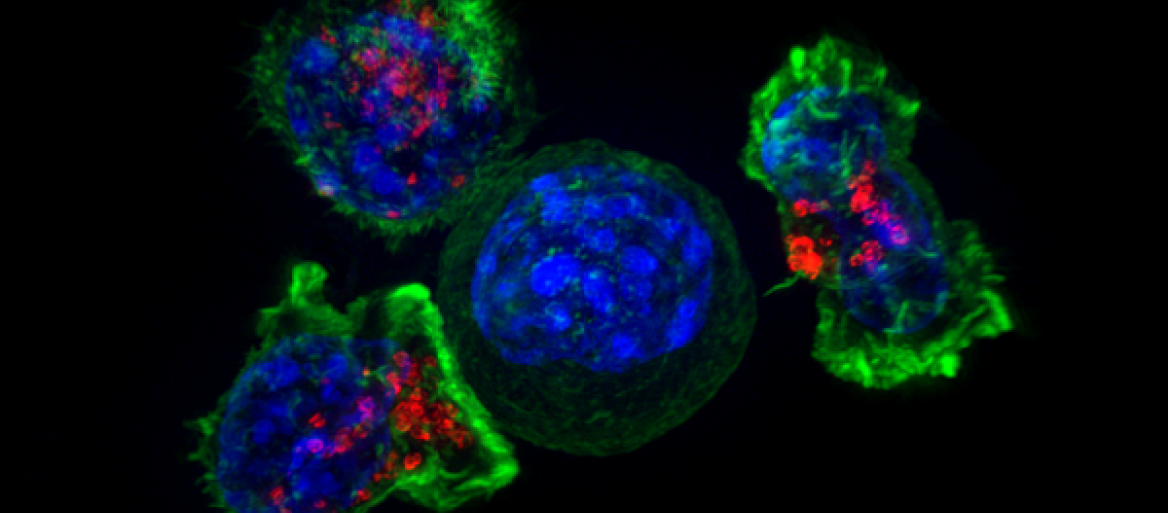 Nowy typ limfocytów T obietnicą rewolucji w leczeniu nowotworów