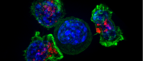 Nowy typ limfocytów T obietnicą rewolucji w leczeniu nowotworów