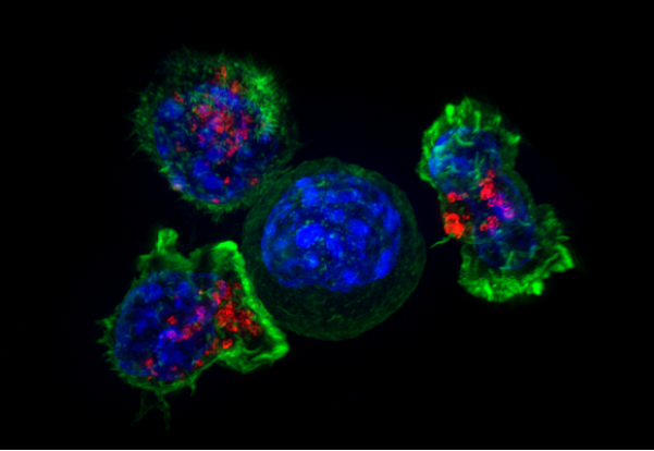 Nowy typ limfocytów T obietnicą rewolucji w leczeniu nowotworów