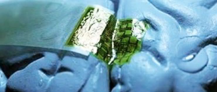 Implant mózgowy zasilany ultradźwiękami