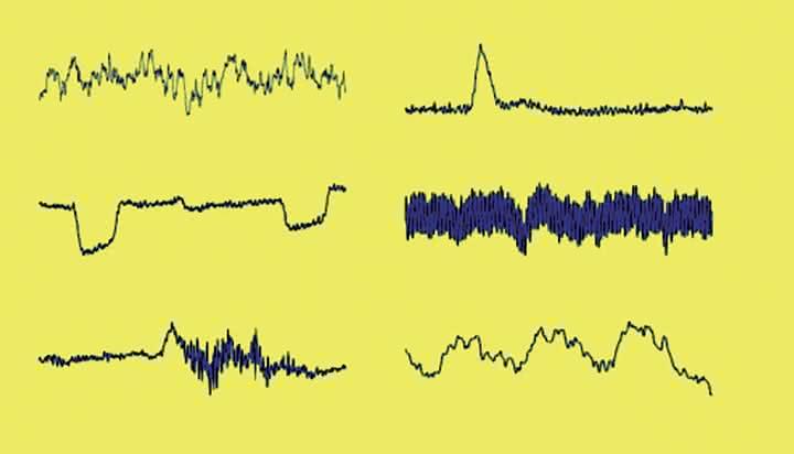 Przebiegi składowych rzeczywistego sygnału EEG