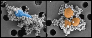 Magnetyczne nanodrobiny walczą z bakteriami, aby usunąć je z krwi